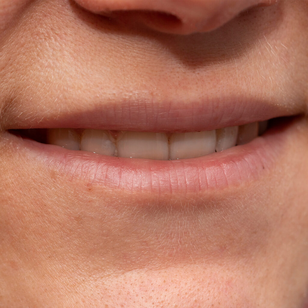 Photo of a woman's thin lips